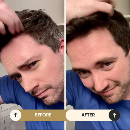 NovaHair Pro™⎪Pflegt dein Haar, verhindert Grau!