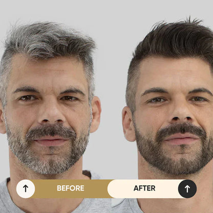 NovaHair Pro™⎪Pflegt dein Haar, verhindert Grau!