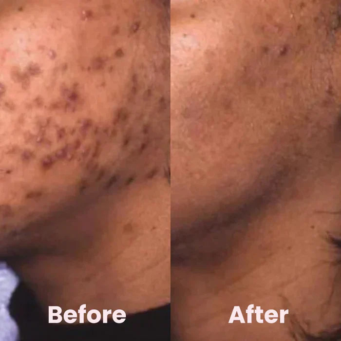 SoothingSkin™ | Beruhige Haut und Geist