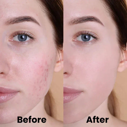 SoothingSkin™ | Beruhige Haut und Geist