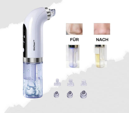 GloClean™⎪Strahlend sauber in wenigen Minuten