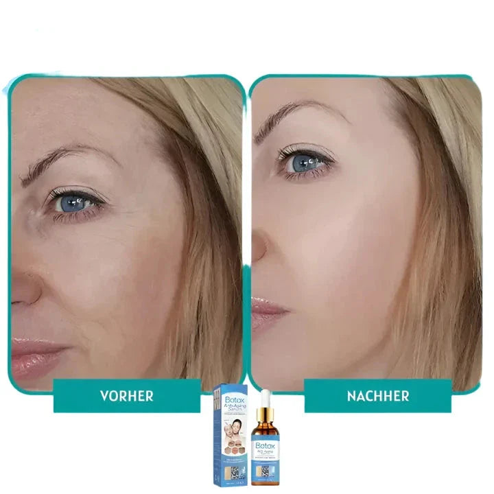 Botox™ Pro | Durst nach Glanz stillen