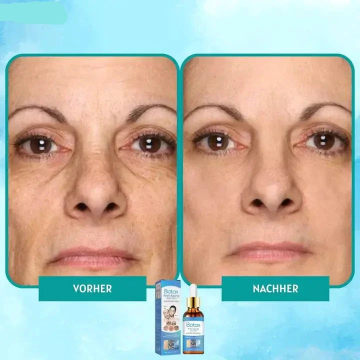 Botox™ Pro | Durst nach Glanz stillen