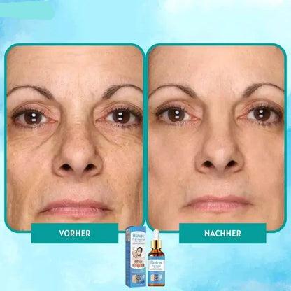 Botox™ Pro | Durst nach Glanz stillen