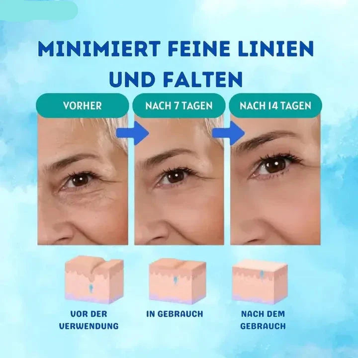 Botox™ Pro | Durst nach Glanz stillen