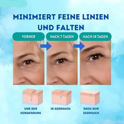 Botox™ Pro | Durst nach Glanz stillen