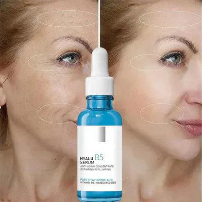 HyaluSerum™ V2 | Alterung mit Tropfen widerstehen
